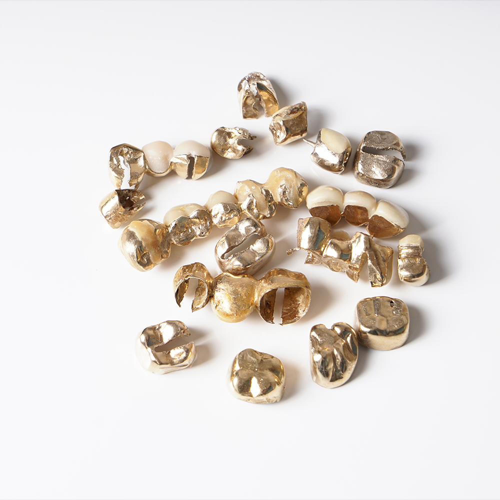 Dental Gold